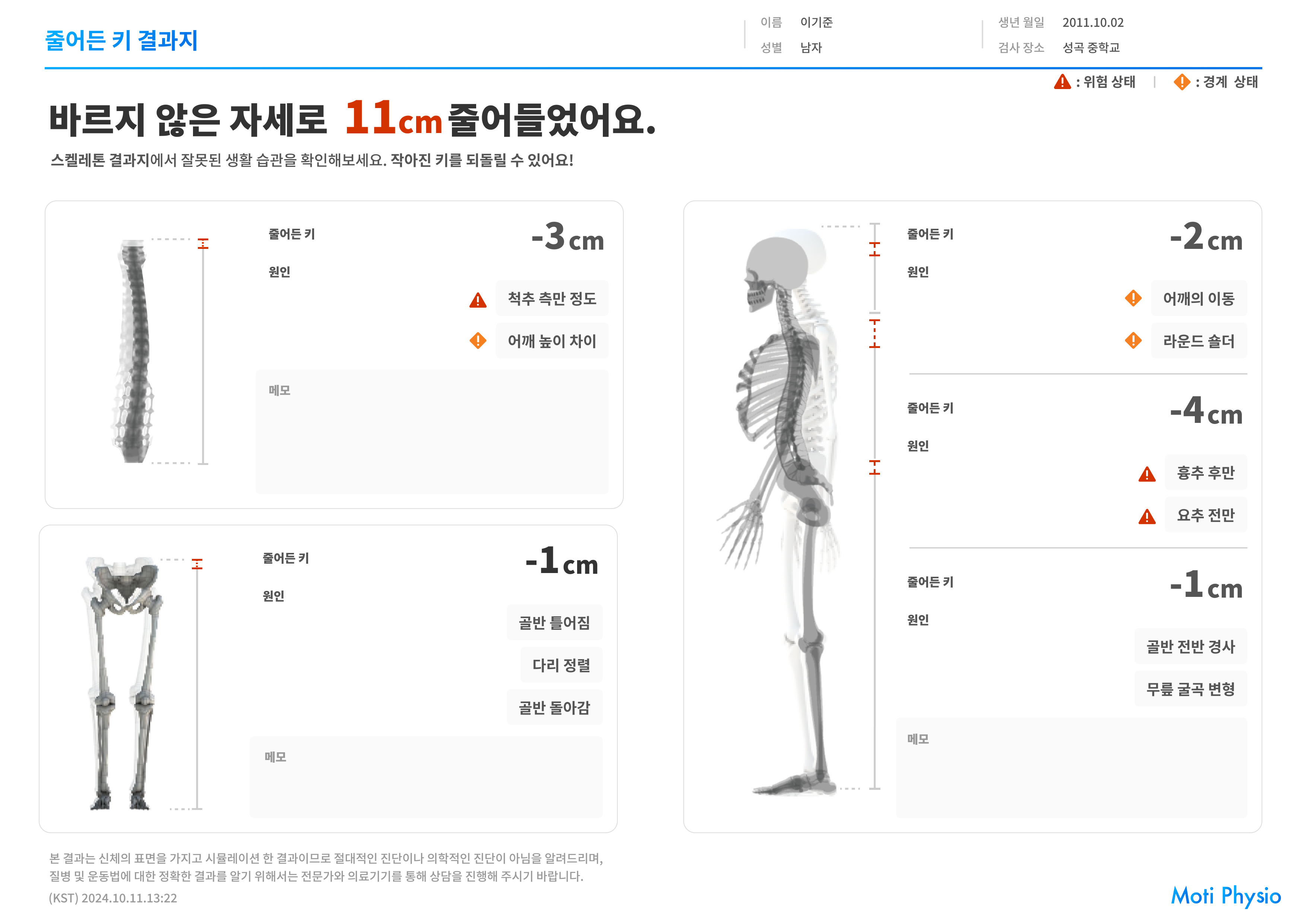 손실키 분석 화면